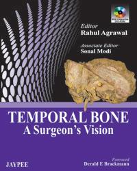 Temporal Bone: A Surgeon's Vision|1/e