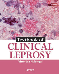 Textbook of Clinical Leprosy|5/e