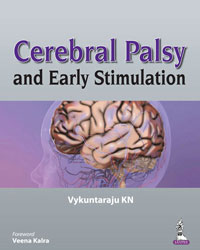 Cerebral Palsy and Early Stimulation|1/e