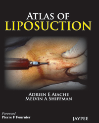 Atlas of Liposuction|1/e