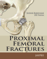 Proximal Femoral Fractures|1/e