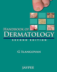Handbook of Dermatology|2/e