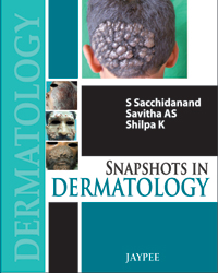 Snapshots in Dermatology|1/e