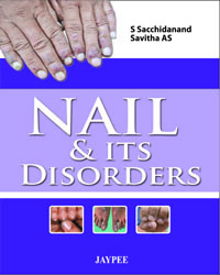 Nail and Its Disorders|1/e