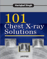 101 Chest X-ray Solutions|1/e