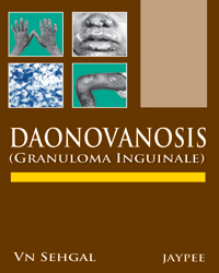 Donovanosis (Granuloma Inguinale)|2/e