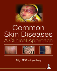 Common Skin Diseases: A Clinical Approach|1/e