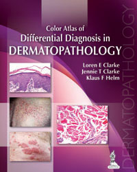 Color Atlas of Differential Diagnosis in Dermatopathology|1/e