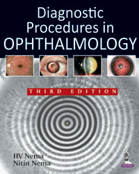 Diagnostic Procedures in Ophthalmology|3/e