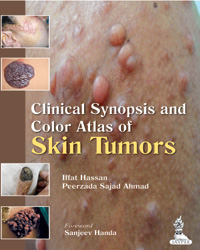 Clinical Synopsis and Color Atlas of Skin Tumors|1/e