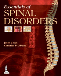 Essentials of Spinal Disorders|1/e