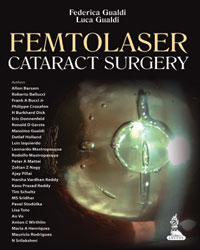 Femtolaser Cataract Surgery|1/e