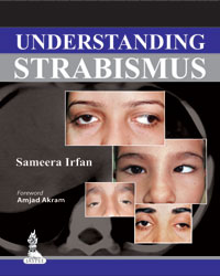 Understanding Strabismus|1/e