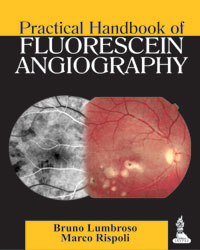 Practical Handbook of Fluorescein Angiography|1/e