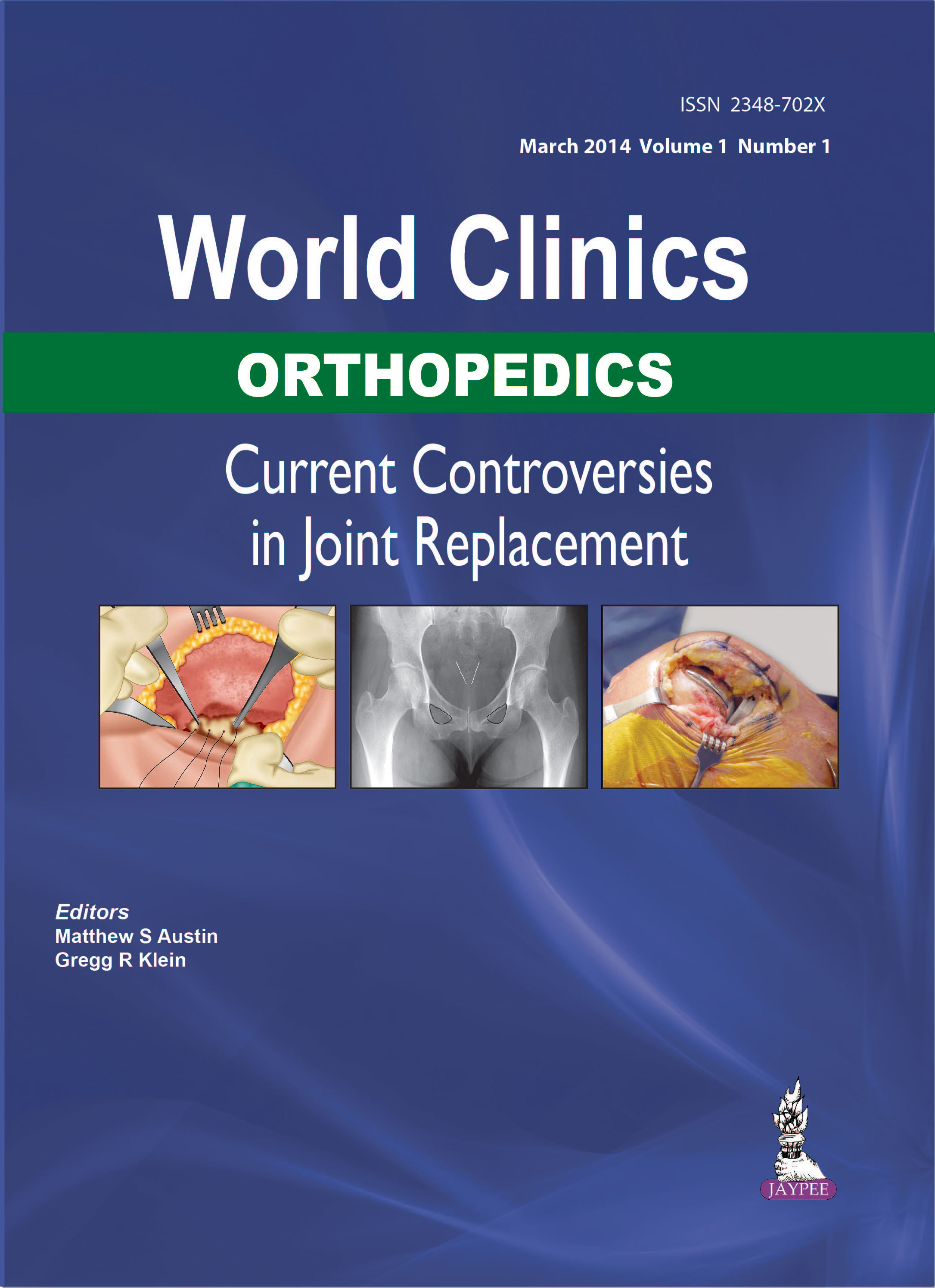 World Clinics Orthopedics : Current Controversies in Joint Replacement|Volume 1  Issue 1