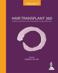 Hair Transplant 360: Advances  Techniques  Business Development  and Global Perspectives (Volume-3)|1/e