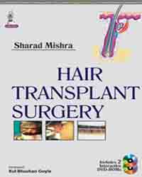 Hair Transplant Surgery|1/e