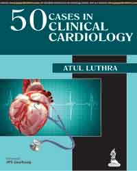 50 Cases in Clinical Cardiology: A Problem Solving Approach|1/e