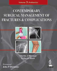 Contemporary Surgical Management of Fractures and Complications: Volume 3: Pediatrics|1/e