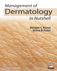 Management of Dermatology in Nutshell|1/e