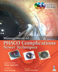 Management of Phaco Complications Newer Techniques|1/e