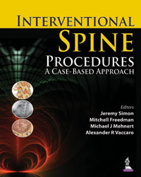 Interventional Spine Procedures: A Case-based Approach|1/e