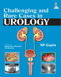 Challenging and Rare Cases in Urology|1/e