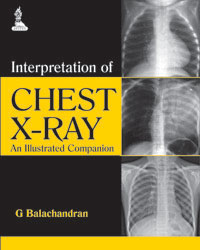 Interpretation of Chest X-ray: An Illustrated Companion|1/e