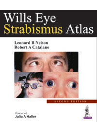 Wills Eye Strabismus Atlas|2/e