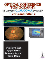 Optical Coherence Tomography in Current Glaucoma Practice Pearls and Pitfalls|1/e