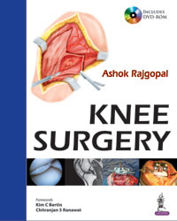Knee Surgery (with Interactive DVD Rom)|1/e