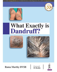 What Exactly is Dandruff?|1/e