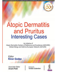 Atopic Dermatitis  and Pruritus Interesting Cases|1/e