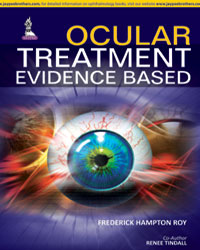 Ocular Treatment: Evidence Based|1/e