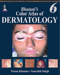 Bhutaniâ€™s Color Atlas of Dermatology|6/e