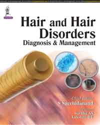 Hair and Hair Disorders Diagnosis and Management|1/e