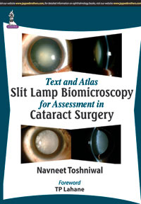 Text and Atlasâ€”Slit Lamp Biomicroscopy for Assessment in Cataract Surgery|1/e