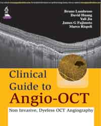 Clinical Guide to Angio-OCT (Non Invasive  Dyeless OCT Angiography)|1/e
