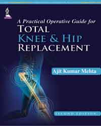 A practical Operative Guide for Total Knee and Hip Replacement|2/e