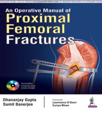 An Operative Manual of Proximal Femoral Fractures (Includes Interactive DVD_ROM)|1/e
