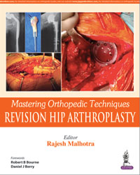 Mastering Orthopedic Techniques Revision Hip Arthroplasty|1/e