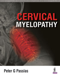 Cervical Myelopathy|1/e