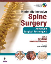 Minimally Invasive Spine Surgery: Advanced Surgical Techniques (Includes Interactive DVD-ROM)|1/e