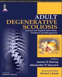 Adult Degenerative Scoliosisâ€”Coronal and Sagittal Deformities: Treatment and Management|1/e