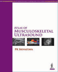 Atlas of Musculoskeletal Ultrasound|1/e