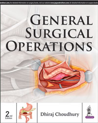 General Surgical Operations|2/e