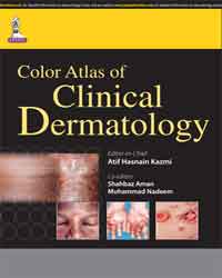 Color Atlas of Clinical Dermatology (Includes Interactive DVD-ROM)|1/e