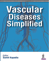Vascular Diseases Simplified|1/e