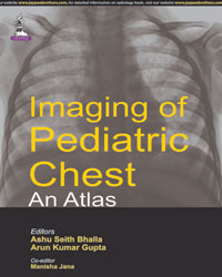 Imaging of Pediatric Chest: An Atlas|1/e
