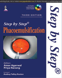 Step by Step Phacoemulsification (with DVD-ROM)|3/e